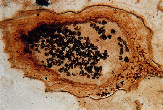 Dwarsdoorsnede van sporangium